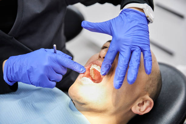 Best Broken or Chipped Tooth Repair in Crosspointe, VA