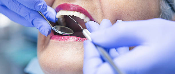 Best Emergency Treatment for Oral Infections in Crosspointe, VA